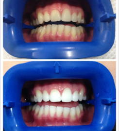 Smile Avenue Dental Surgery Publika